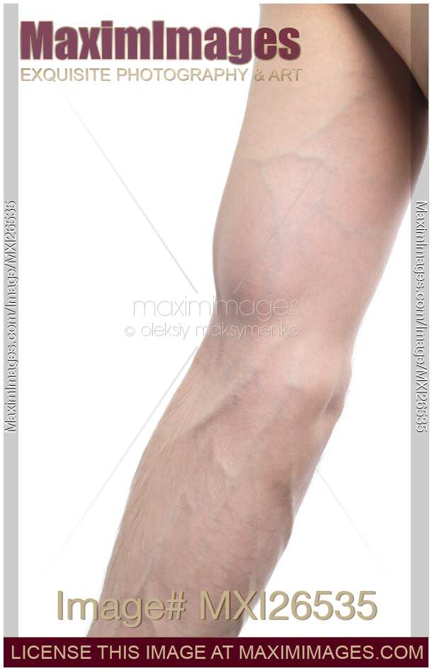 Closeup of arm and elbow