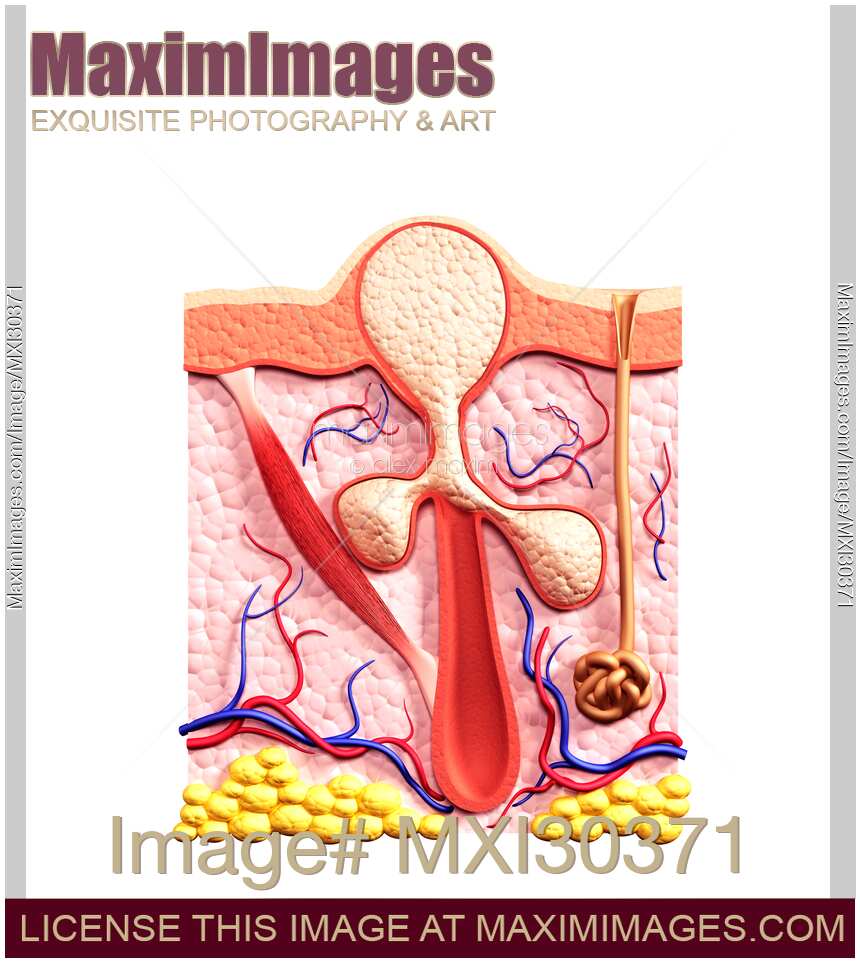 Cross section of whitehead skin follicle filled with sebum structure