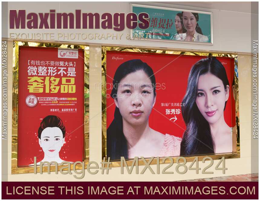 Plastic surgery ad in China