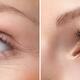 Womans Eye with and without Wrinkles... (thumbnail)