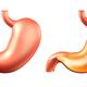 Human stomach and stomach acid illustration... (thumbnail)