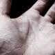 Closeup of skin on man palm... (thumbnail)