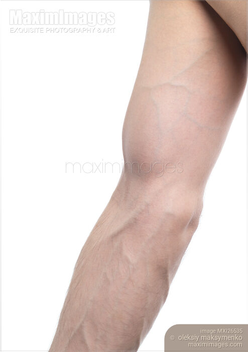 Stock photo of Closeup of arm and elbow Buy commercial use license at MaximImages