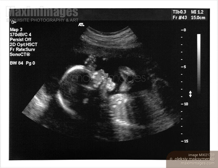 Stock photo of Ultrasound Imaging of a baby fetus Buy commercial use license at MaximImages