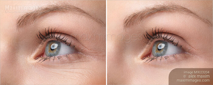 Stock photo of Womans Eye with and without Wrinkles Buy commercial use license at MaximImages